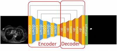 Computer-Aided Diagnosis Evaluation of the Correlation Between Magnetic Resonance Imaging With Molecular Subtypes in Breast Cancer